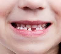 Dentes de leite