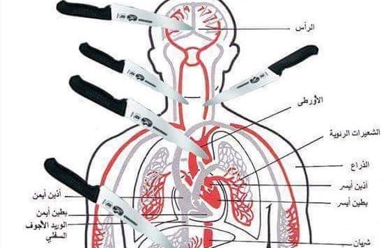 Imagem mostra os pontos principais do corpo a serem atingidos por uma faca, causando rápida fatalidade. (Foto: Times of Israel)