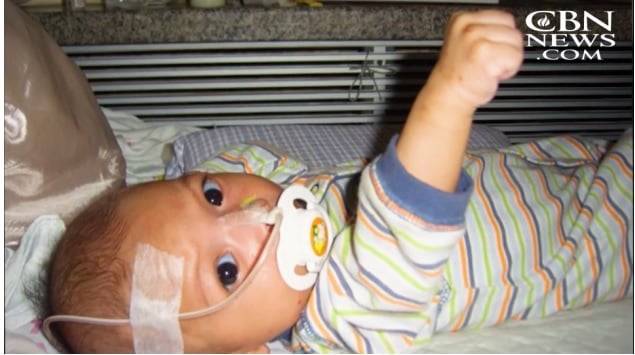 Um tumor na boca, impedia que o bebê se alimentasse normalmente. (Imagem: CBN News)
