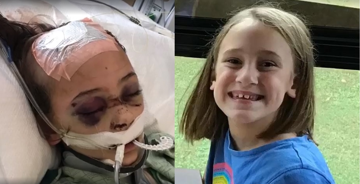 Chloe Clark foi diagnosticada com meningite bacteriana. (Imagem: Facebook)
