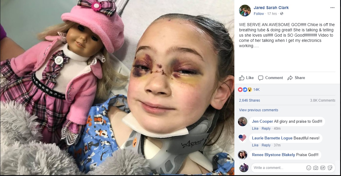 Uma foto da garota já acordada foi publicada pelo pai no hospital. (Foto: Facebook)