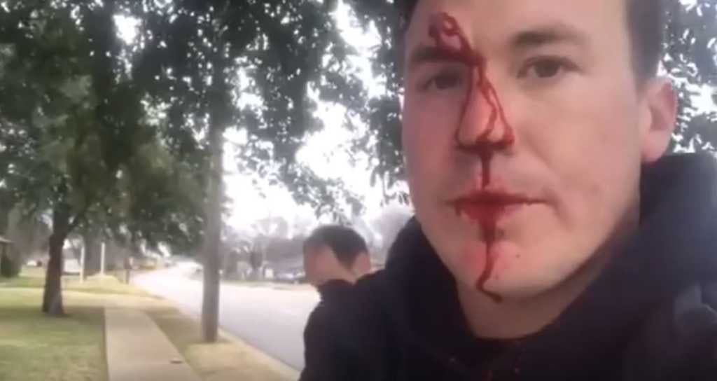 Ryan Roberts ensanguentado após sofrer agressões por causa de seu ativismo pró-vida. (Foto: Reprodução/YouTube).