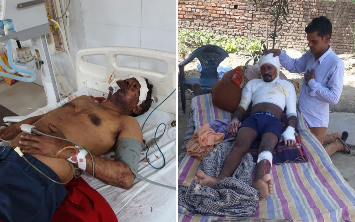 Cristãos espancado e pastor que teve o corpo incendiado recebe oração de um cristão, irmão do pastor Rashphal. (Foto: Divulgação/Rashphal.)