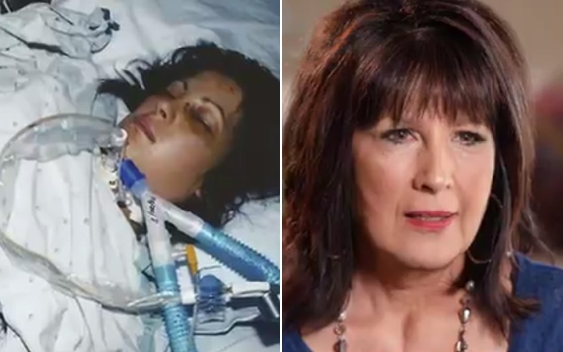 Valerie em coma na UTI na época do acidente e hoje. (Foto: Reprodução/CBN News)