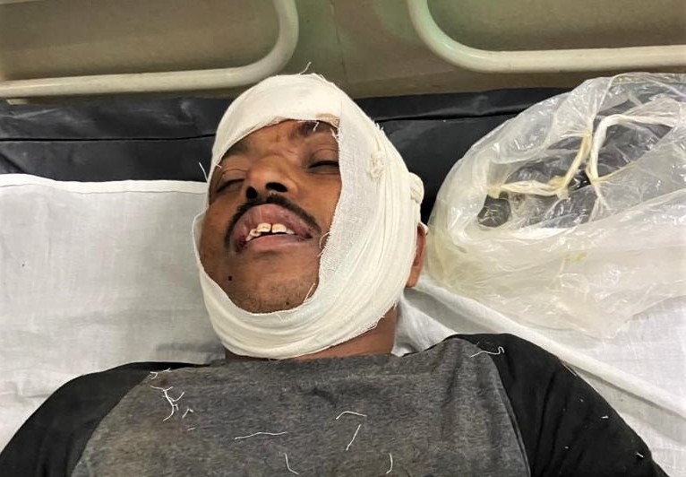 o pastor Isaac Paulose, 48 anos, foi espancado e atropelado cinco vezes por motos. (Foto: Morning Star News)