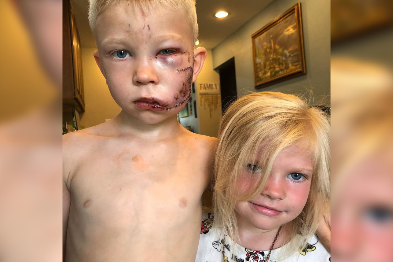Bridger Walker arriscou sua própria vida para salvar a irmã de um ataque de cachorro. (Foto: Instagram)