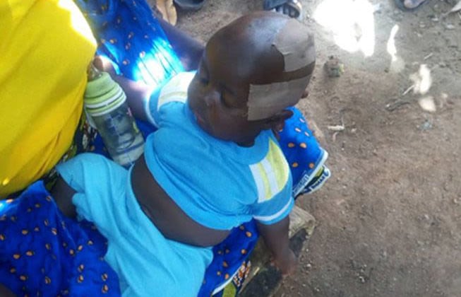 Criança nigeriana foi ferida em ataque Fulani que tirou a vida de seu pai. (Foto: Barnabas Fund)