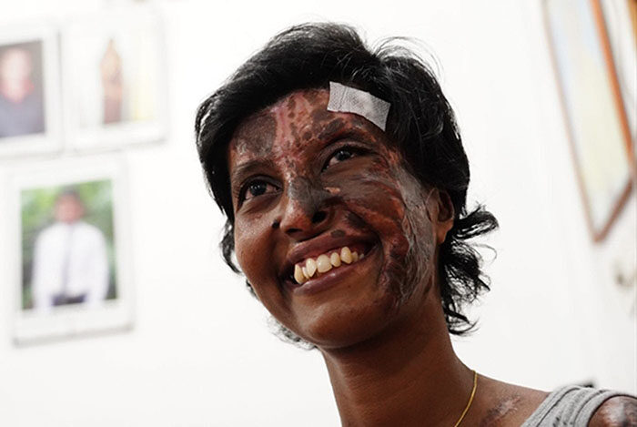 A cristã Rebekah com marcas da explosão feita por terroristas em uma igreja no Domingo de Páscoa. (Foto: Reprodução / UGCN)