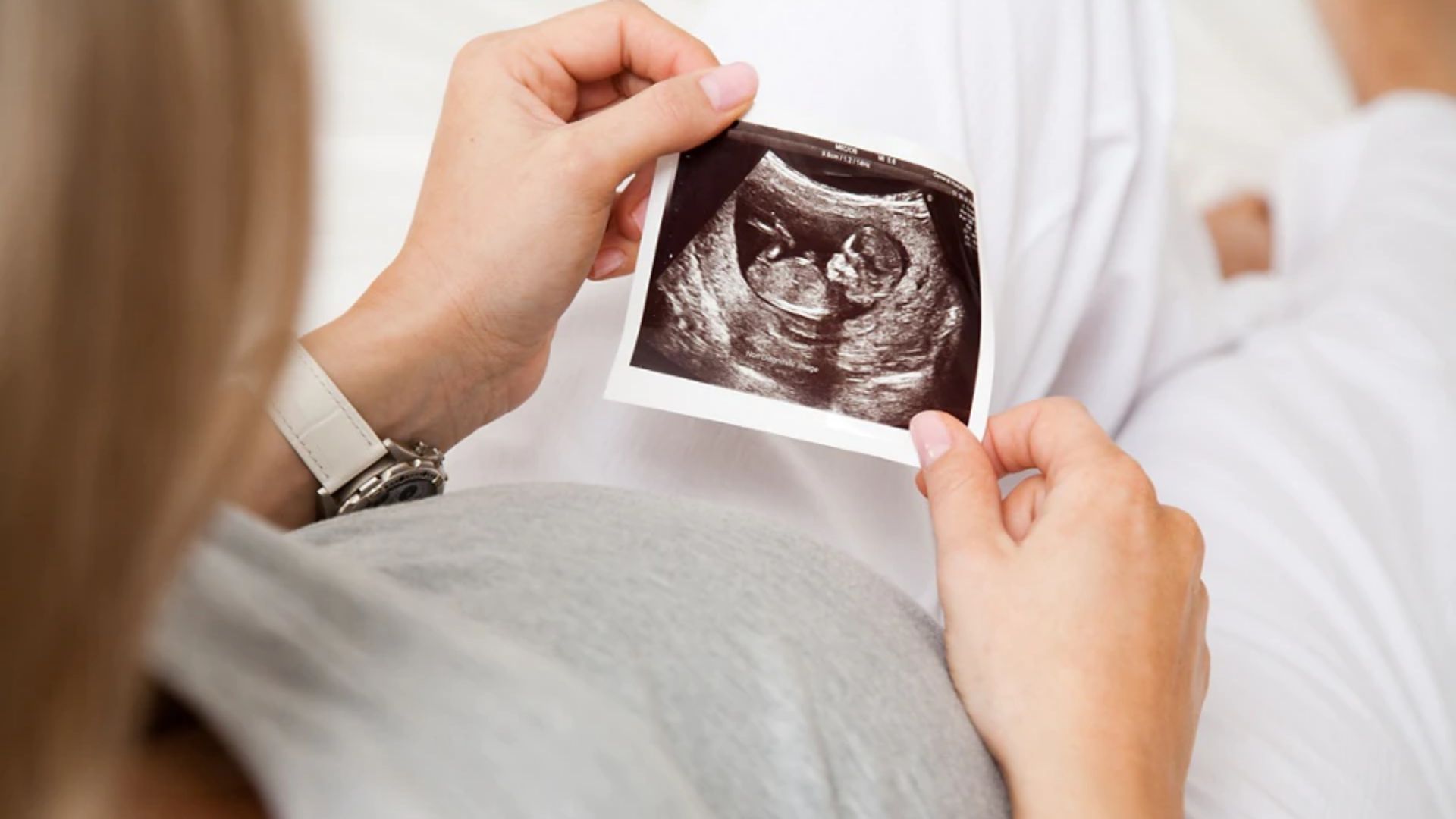 Até janeiro de 2021, mais de 62 milhões de abortos foram realizados nos EUA, desde sua legalização. (Foto: Shutterstock)