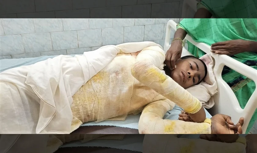 Nitish Kumar, de 16 anos, foi vítima de um ataque com ácido de extremistas hindus. (Foto: Morning Star News).