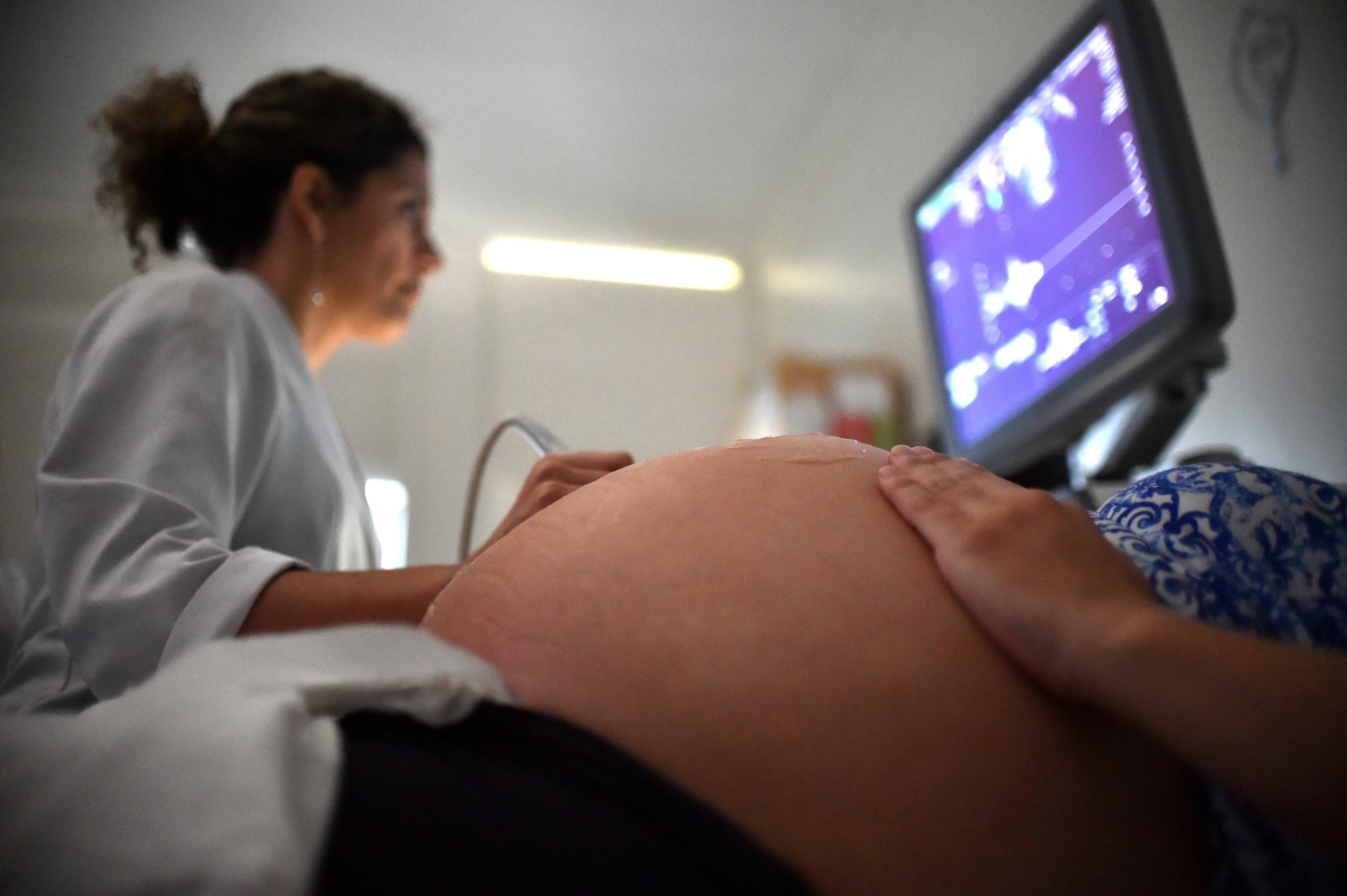 Mãe de gêmeos desiste de aborto após ver bebês em ultrassom