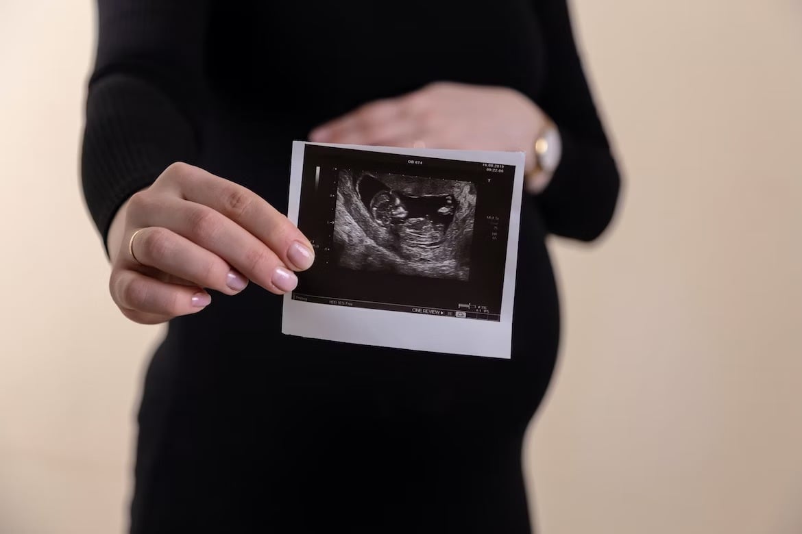 Abortos atingiram níveis recordes na Escócia: “É perturbador”