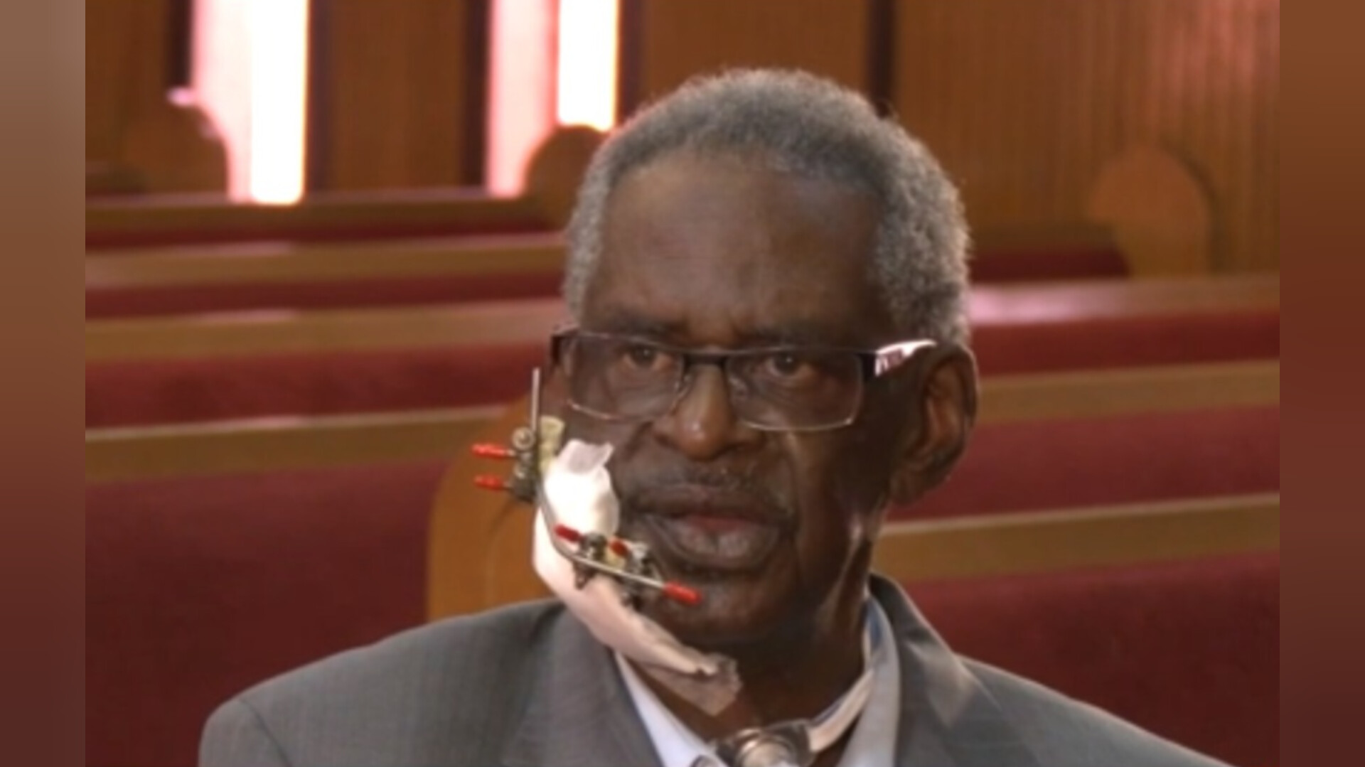 Pastor baleado na boca em assalto fala pela primeira vez: “Mantive minha fé”