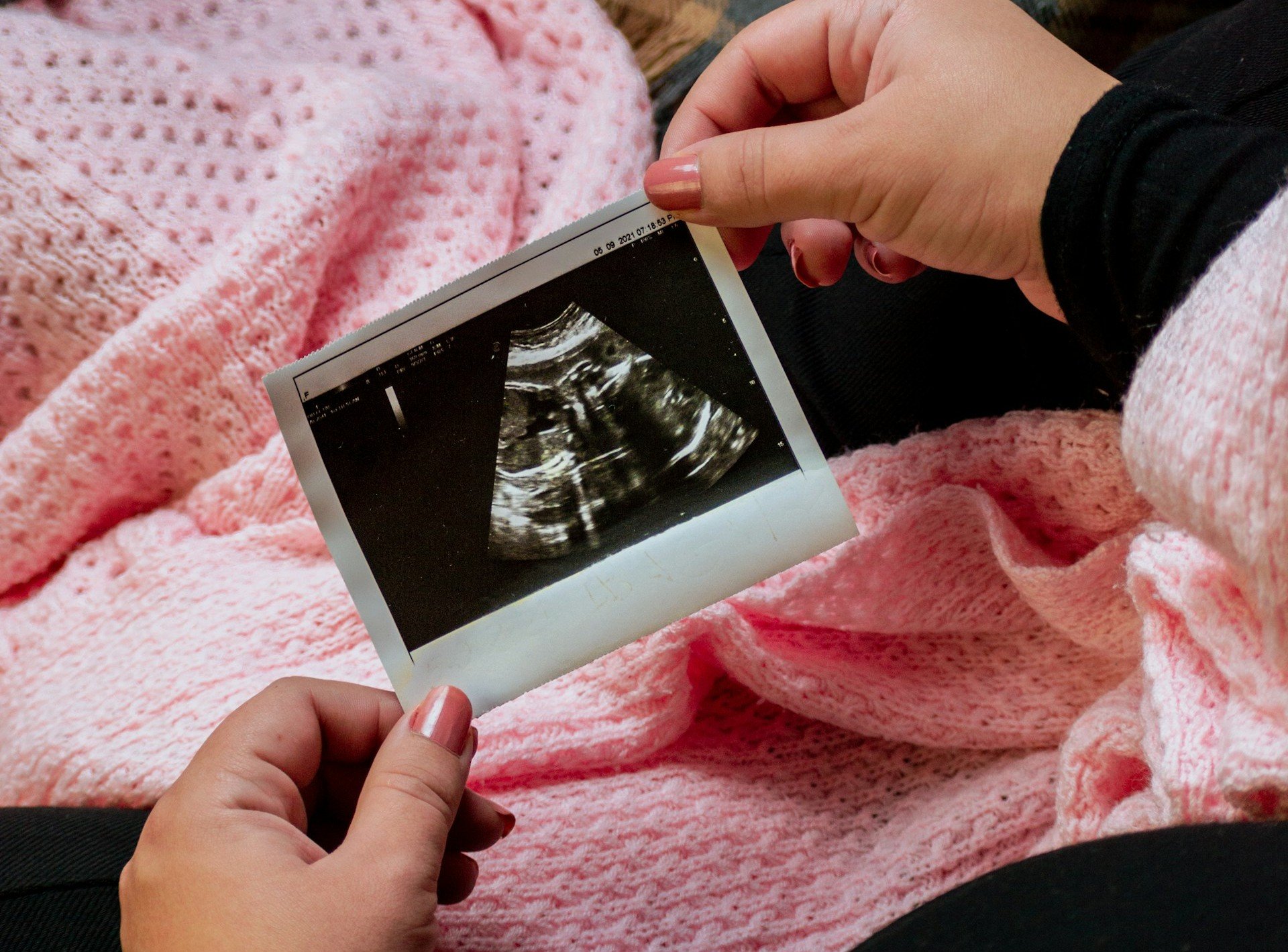 'Lei do Batimento Cardíaco' salva 23.000 bebês do aborto, na Flórida