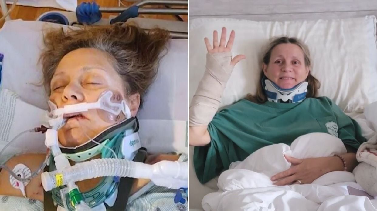 Mulher sobrevive a acidente após hemorragia cerebral: “Deus tem um plano”