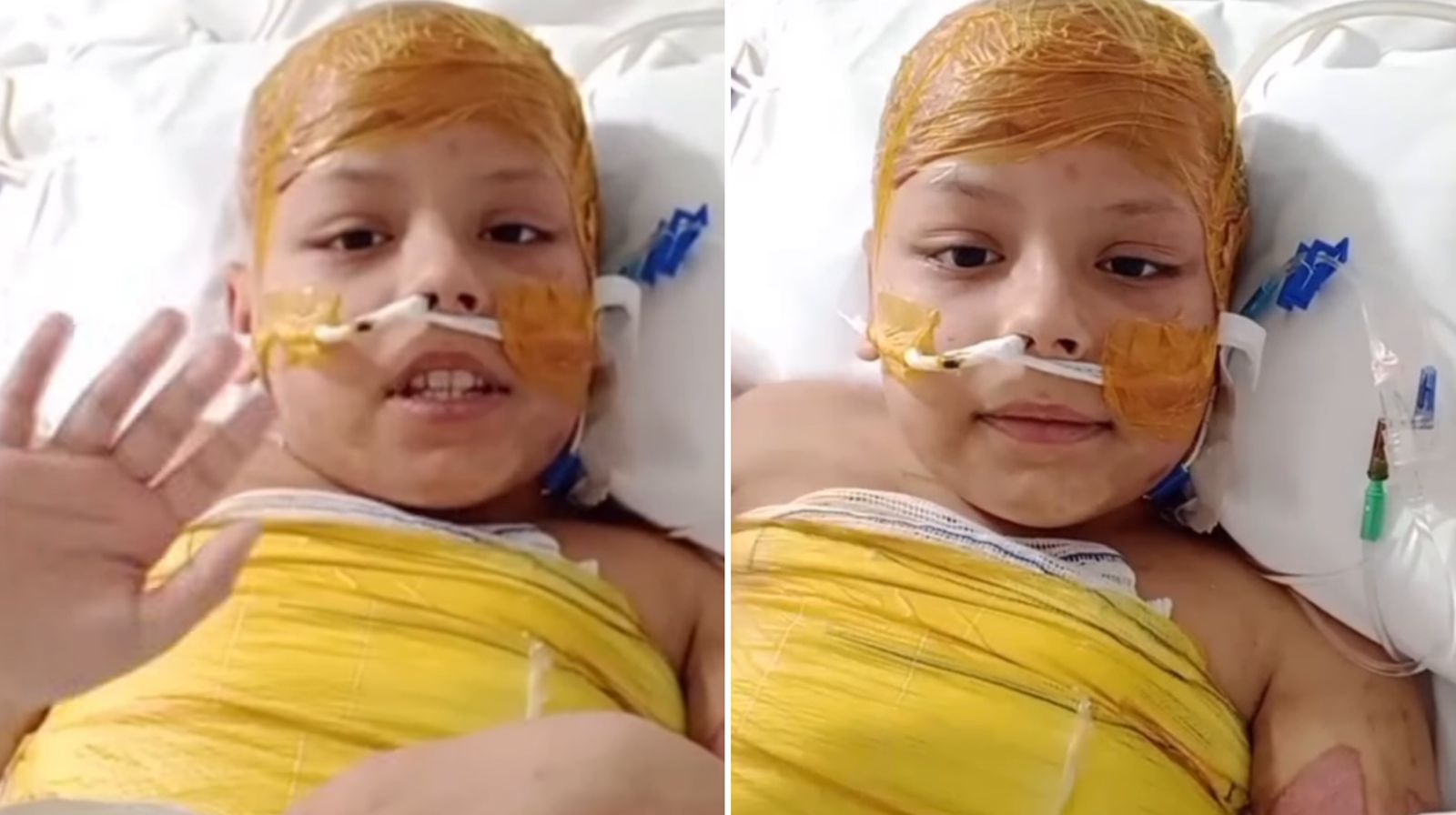 “Milagre”: Menino de 8 anos sobrevive após levar choque de 25 mil volts