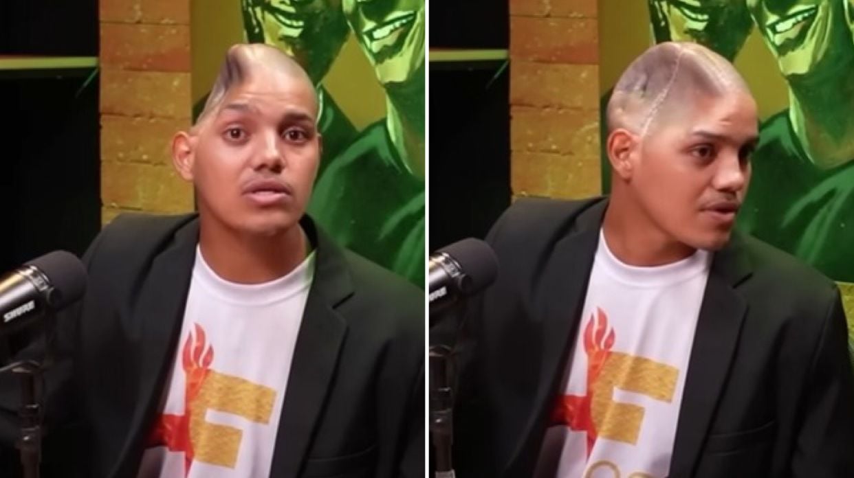 Após levar tiro de fuzil, jovem abandona o crime e aceita Jesus: ‘Em Deus sou saciado’
