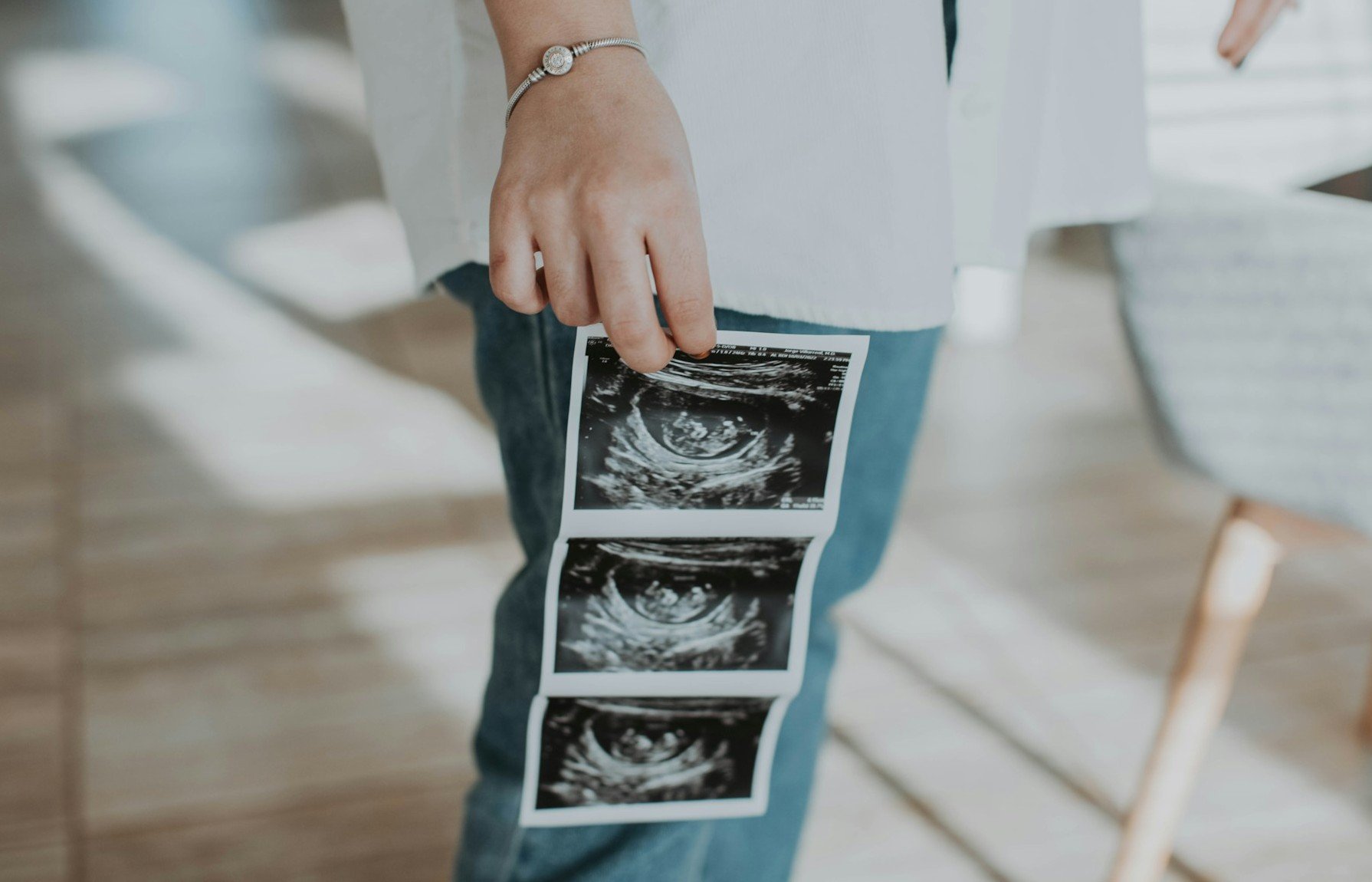 Escócia registra recorde histórico em números de abortos 