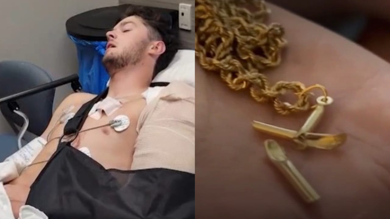 Jovem sobrevive a tiro após bala atingir colar de cruz: 