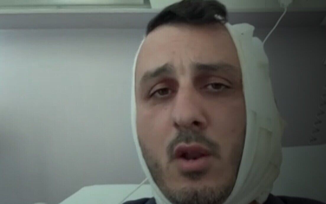 Turista israelense tem orelha arrancada na Grécia por homem que gritou: “Eu sou o Hamas”