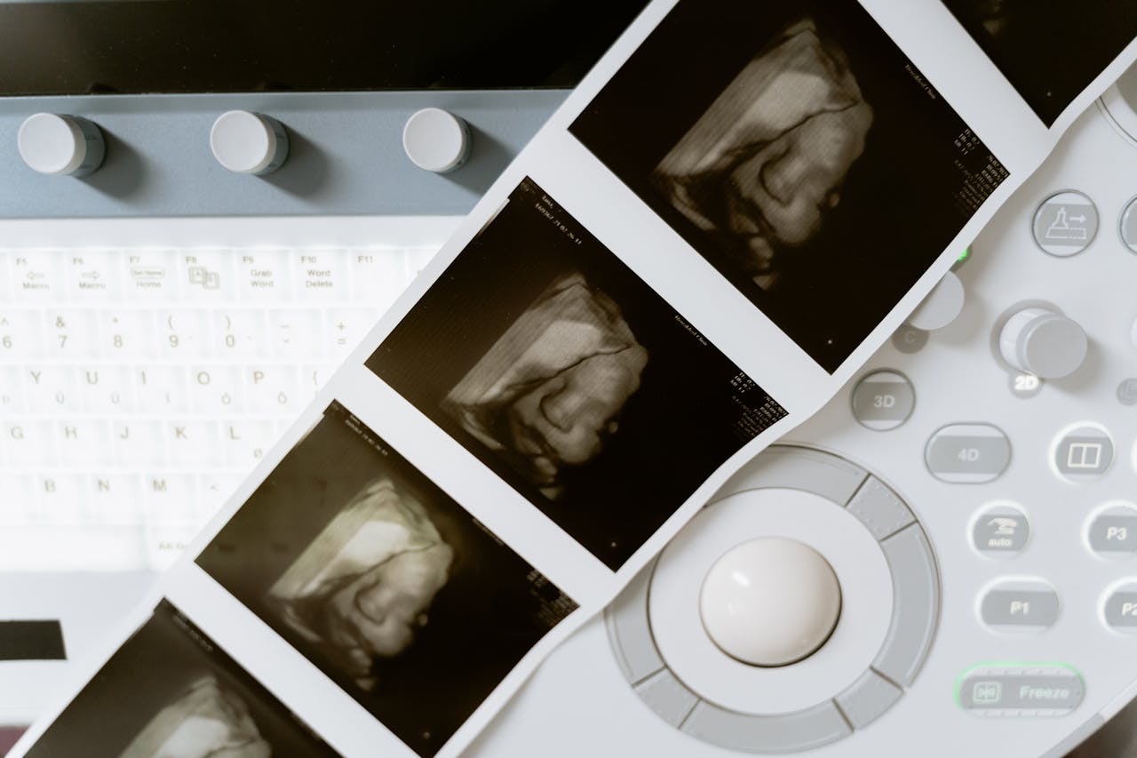 Irlanda registra quase 11 mil abortos e estabelece novo recorde em 2024