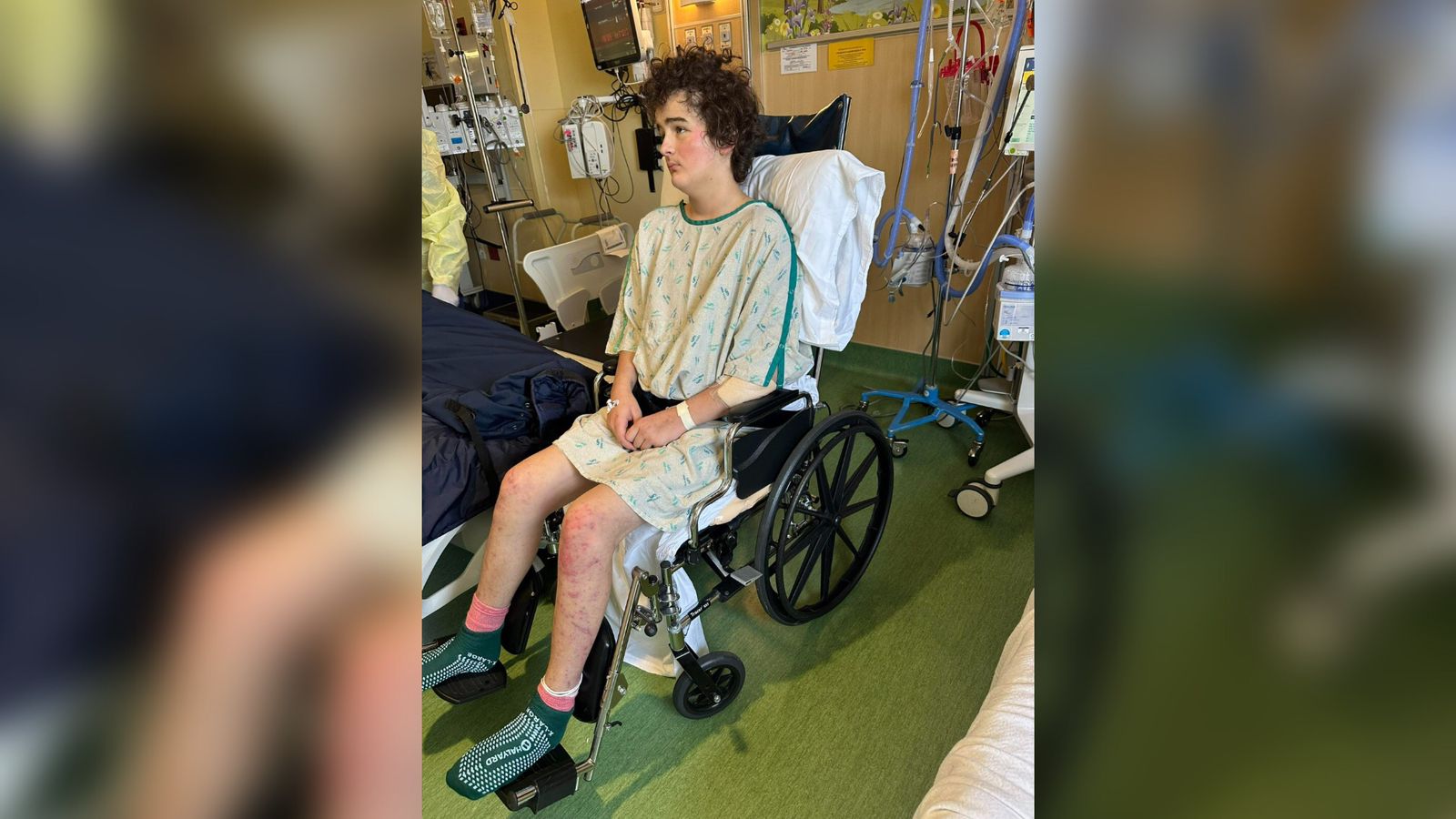 Menino sobrevive à queda de 73 metros e acorda após 11 dias em coma: “Ele é um milagre”
