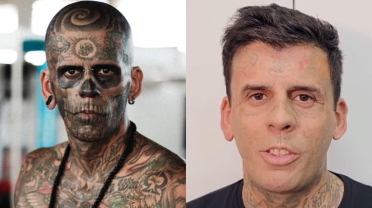 Homem mais tatuado do Brasil que se converteu remove tatuagens do rosto: “É sobre Jesus”