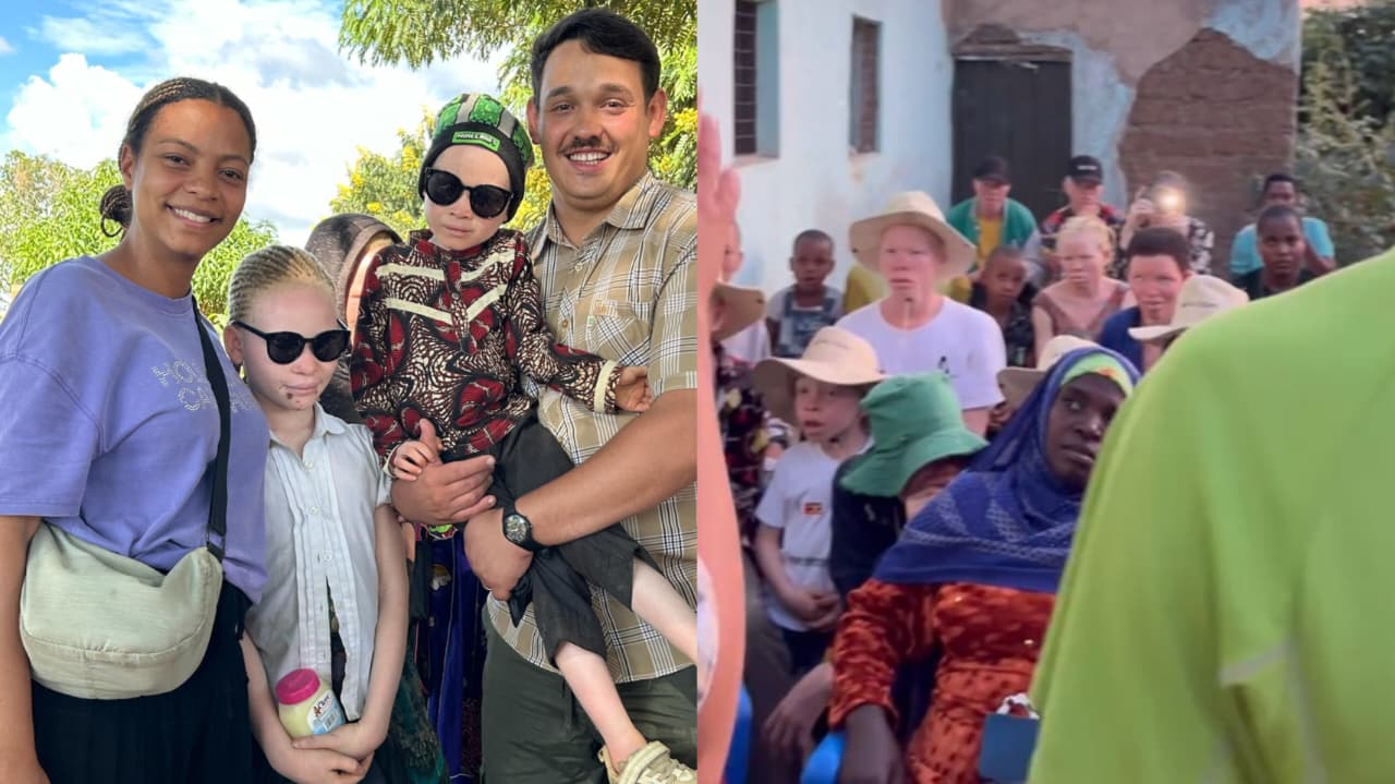 Missionários brasileiros ajudam albinos perseguidos na África: “Correm risco de sequestro”