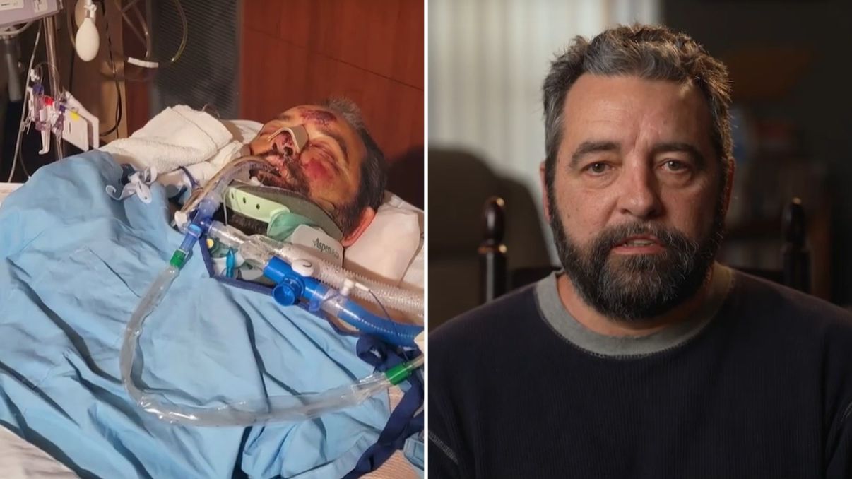 Homem que passou por 25 cirurgias após ser atropelado testemunha: “Sou um milagre”