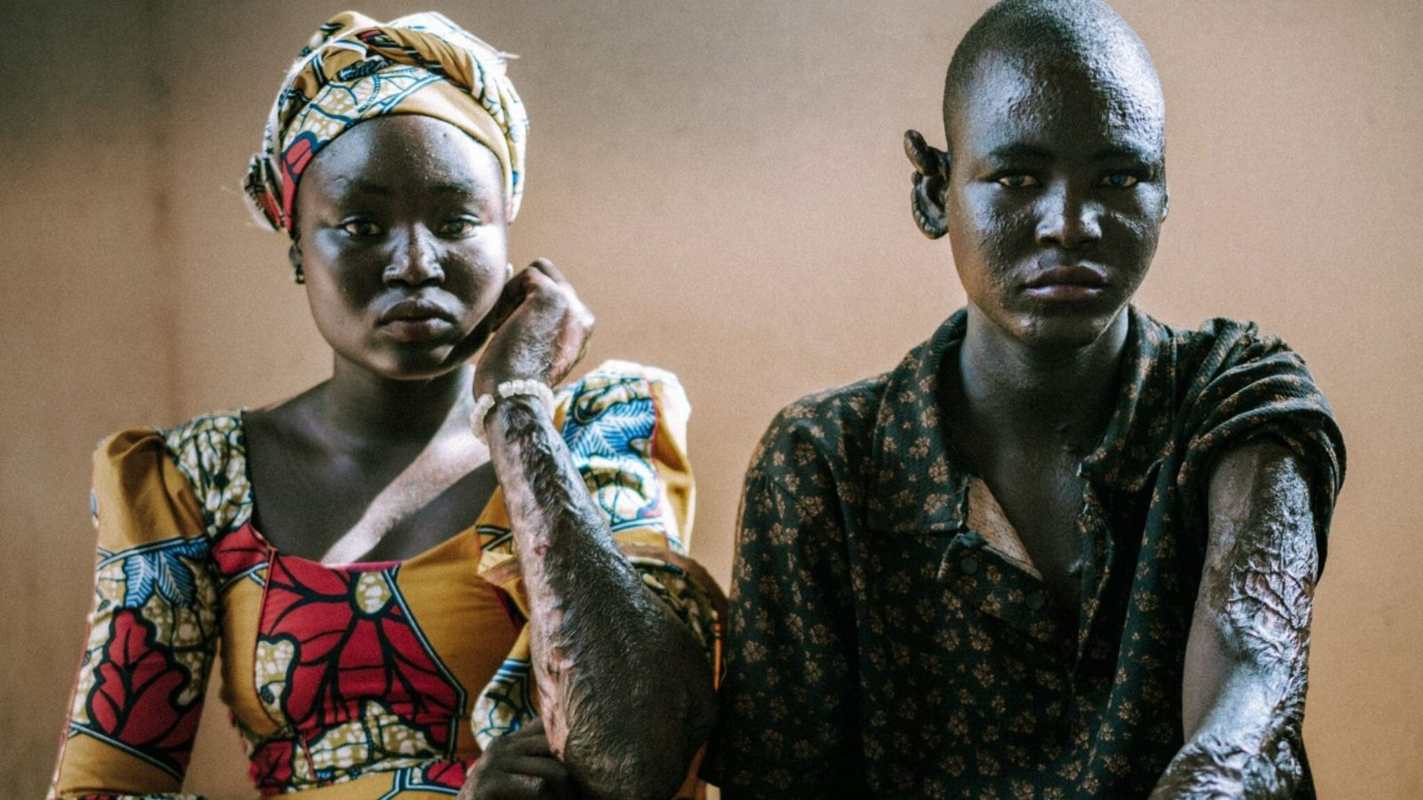 Após perderem a família em ataque do Boko Haram, órfãos relatam: ‘Deus mandou perdoar’