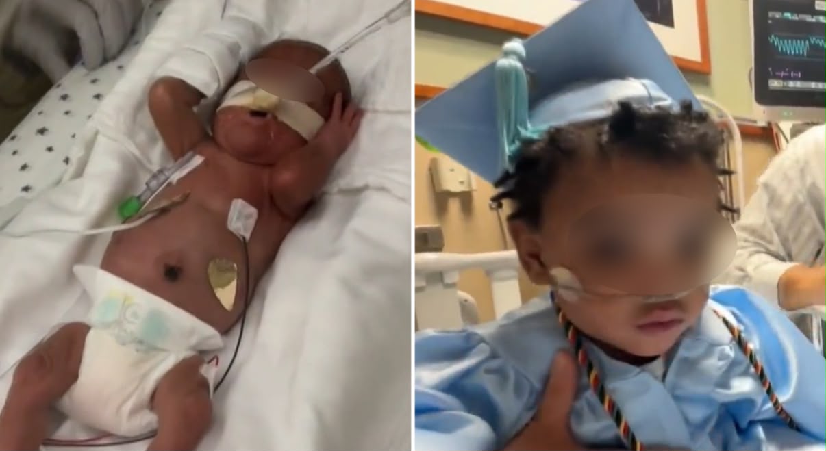 Bebê prematuro recebe alta após nascer com apenas 24 semanas: “Um milagre”